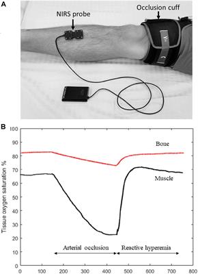 The Case for Measuring Long Bone Hemodynamics With Near-Infrared Spectroscopy